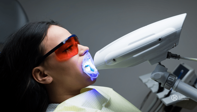 Sbiancamento denti con il laser
