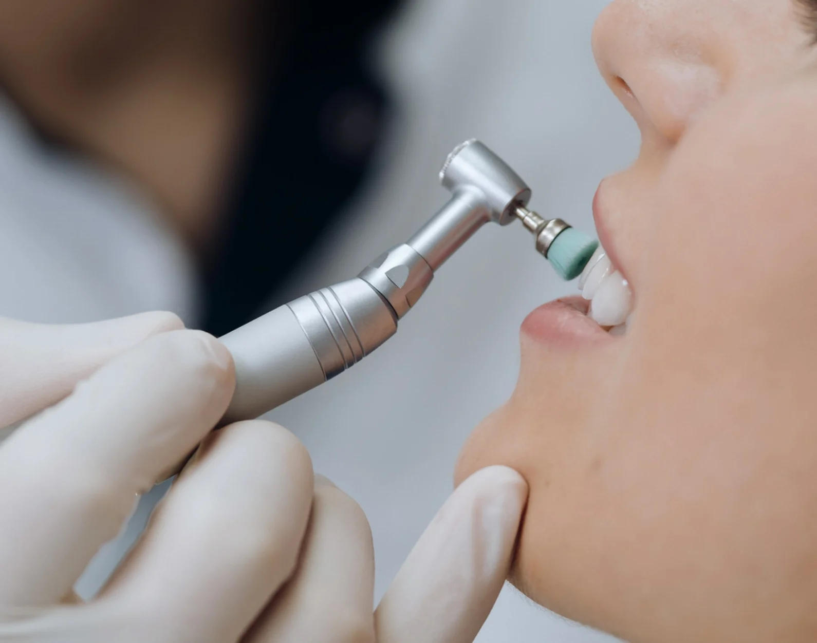 5 falsi miti su prevenzione e igiene orale_articolo